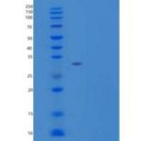 人炭疽毒素受体1重组蛋白