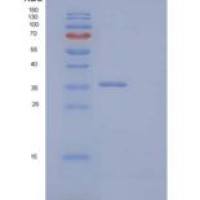 人细胞周期素D2(CCND2)重组蛋白N-6His