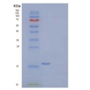 人结缔组织生长因子/CTGF/CCN2重组蛋白