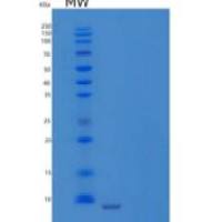 人甲状旁腺激素1-84(PTH)重组蛋白