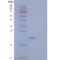 人泛素结合酶E2 B/UBE2B/HR6B重组蛋白C-6His