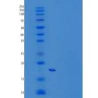 人PDCD4/H731重组蛋白C-6His