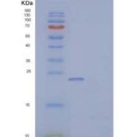 小鼠胰岛素样生长因子结合蛋白6(IGFBP6)重组蛋白C-6His