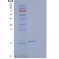 人白介素-17F/INHA重组蛋白C-6His