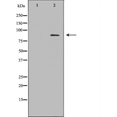 ECE1 Antibody