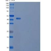 小鼠白介素22(IL22)重组蛋白C-mFc