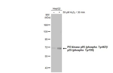 PI3 kinase p85 (phospho Tyr467