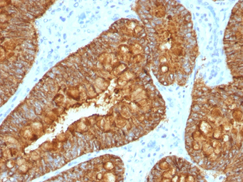 MAML3 antibody [MAML3/1303]
