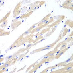 SSA1 antibody
