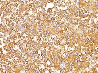 Melanoma gp100 antibody [SPM14