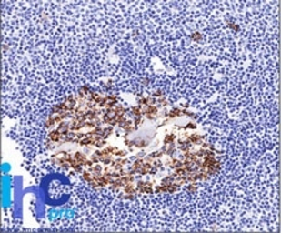 CDw75 antibody [LN-1]
