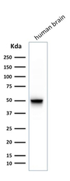 GFAP antibody [SPM248]