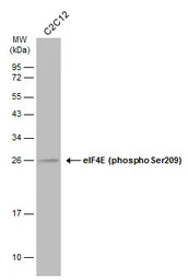 eIF4E (phospho Ser209) antibod