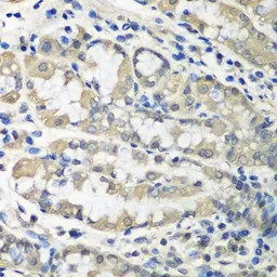 TCP1 zeta antibody