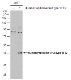 Human Papillomavirus type 18 E