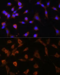 alpha Glucosidase II antibody