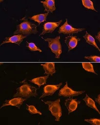 ZCCHC11 antibody