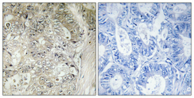 Cystatin SN antibody