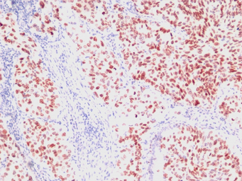 NKX2.1 antibody [SPM150]