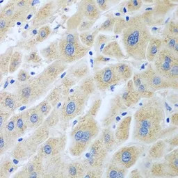 Flavin reductase antibody