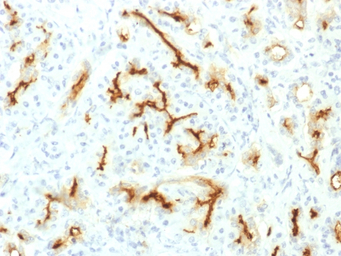 CFTR antibody [CFTR/1775R]