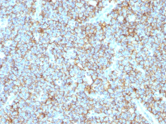 CD99 antibody [MIC2/1495R]