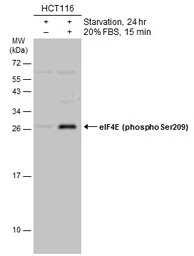 eIF4E (phospho Ser209) antibod