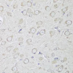 alpha Glucosidase II antibody