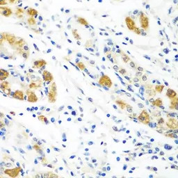 Flavin reductase antibody