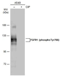 FGFR1 (phospho Tyr766) antibod