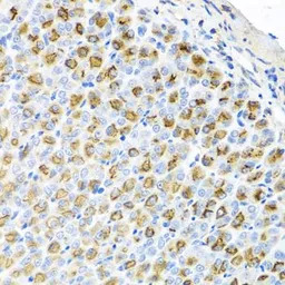 Ferrochelatase antibody