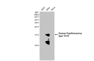 Human Papillomavirus type 16 E
