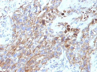 NCAM antibody [NCAM1/795]