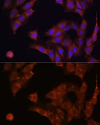 alpha Glucosidase II antibody