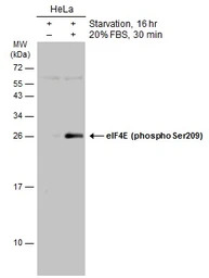 eIF4E (phospho Ser209) antibod