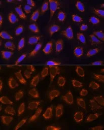 alpha Glucosidase II antibody