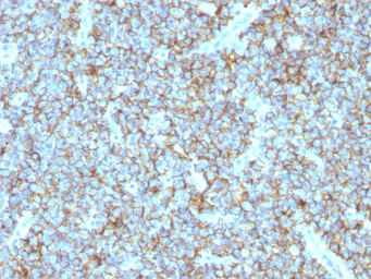 CD99 antibody [MIC2/877]