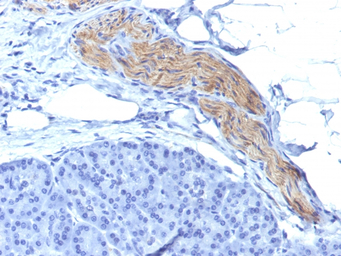 NCAM antibody [NCAM1/795]