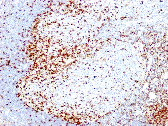 ZAP70 antibody [2F3.2]