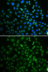 SSA1 antibody