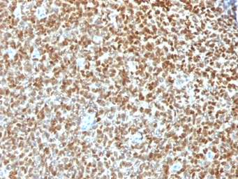 Nkx2.2 antibody [NX2/1422R]