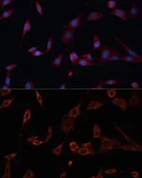 PDIA2 / PDIP antibody