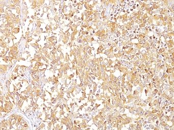 Melanoma gp100 antibody [SPM14