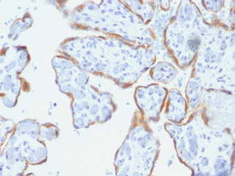 TIMP2 antibody [SPM356]