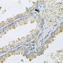 Cyclophilin C antibody