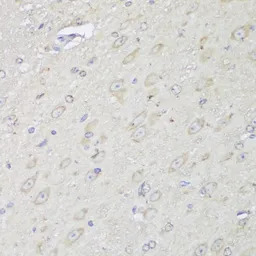 alpha Glucosidase II antibody