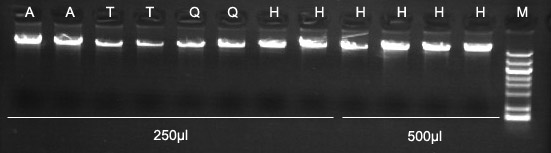 血液基因组DNA提取试剂盒应用实例