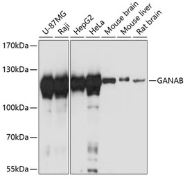 alpha Glucosidase II antibody