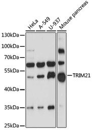 SSA1 antibody