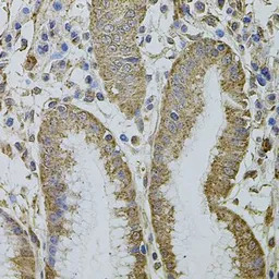 MTIF3 antibody